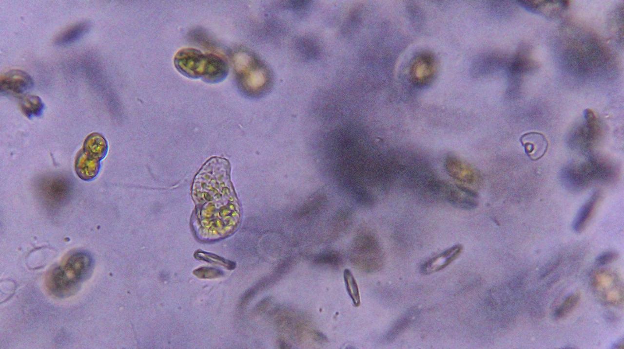Quando la manutenzione latita, la Natura ringrazia